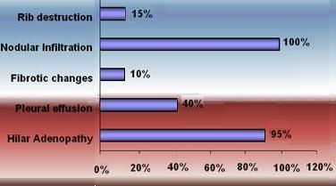 Figure 2-Chest CT-scan findings in CGD patients