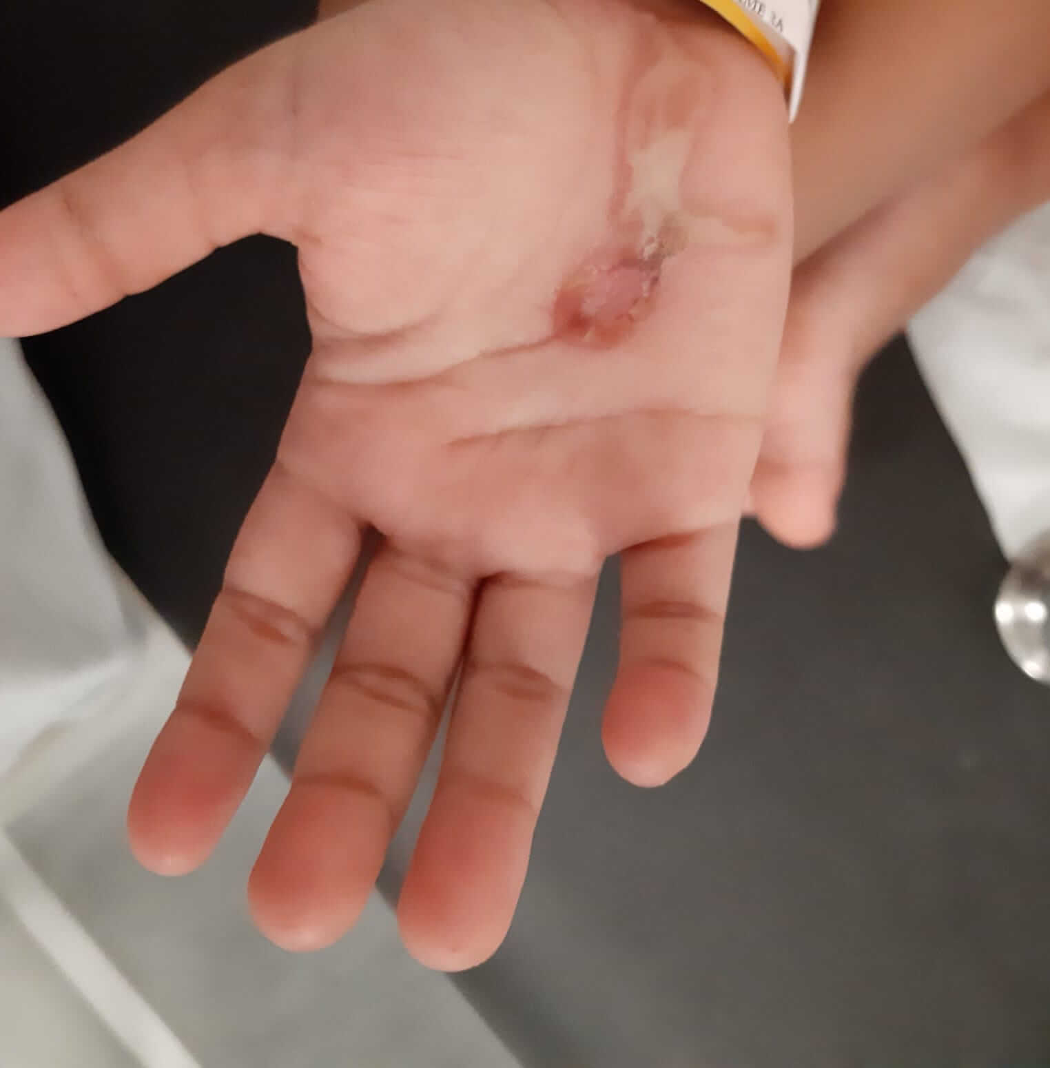 Spot Diagnosis