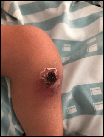 Spot Diagnosis