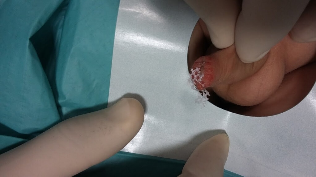 Spot Diagnosis