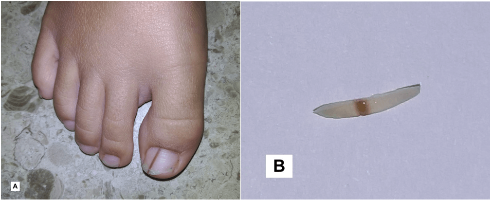 Spot Diagnosis