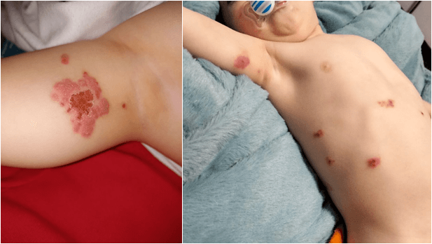 Spot Diagnosis