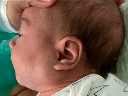 Spot Diagnosis