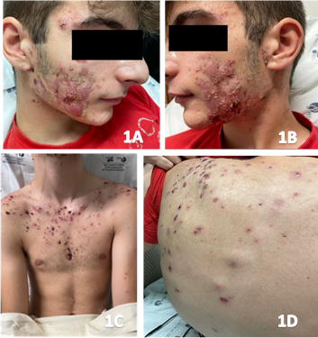 Spot Diagnosis