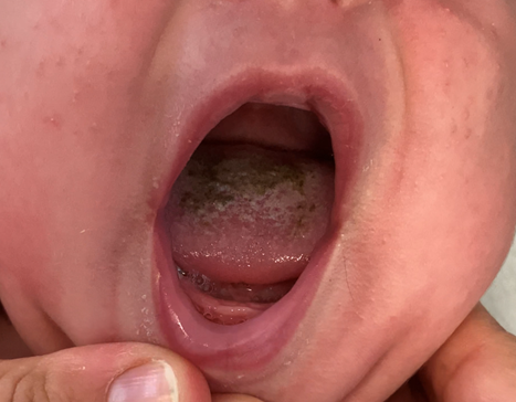 Spot Diagnosis