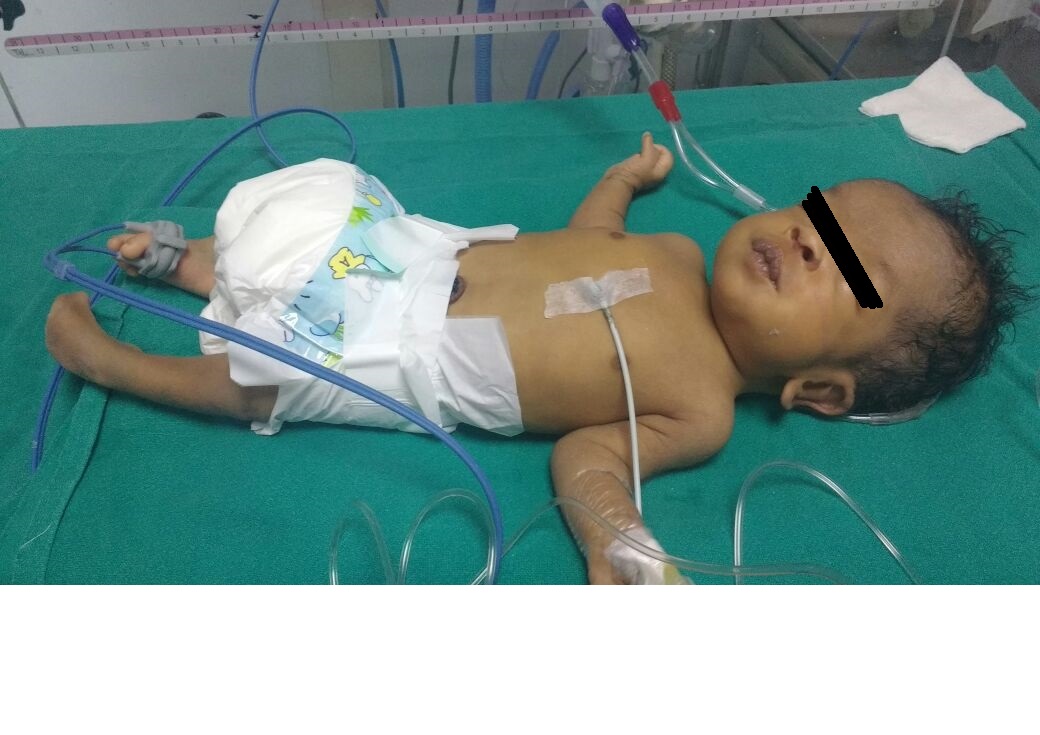Multiple Congenital Abnormalities