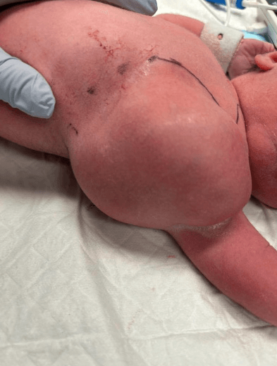 Spot Diagnosis