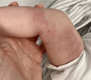 Spot Diagnosis