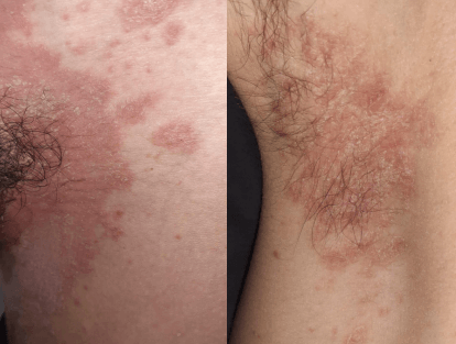 Spot Diagnosis