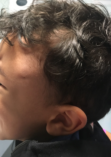 Spot Diagnosis
