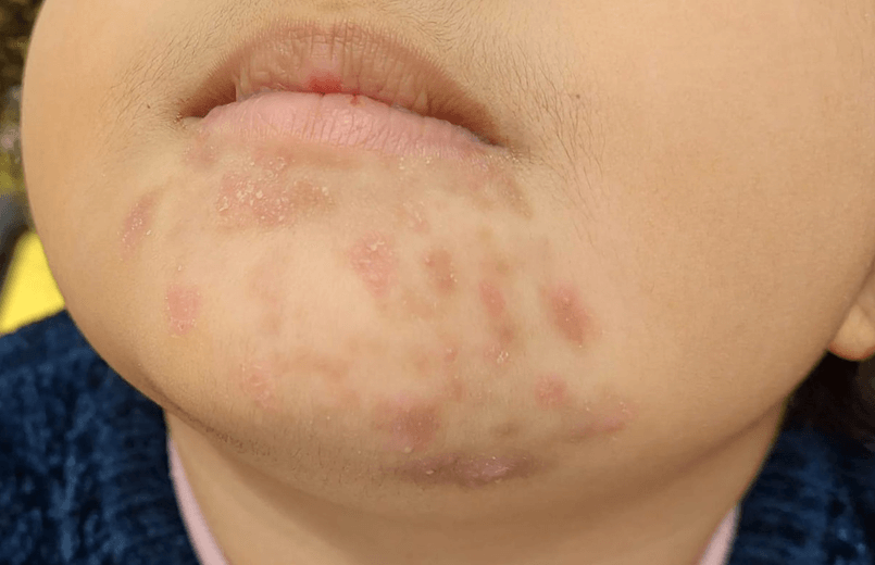 Spot Diagnosis