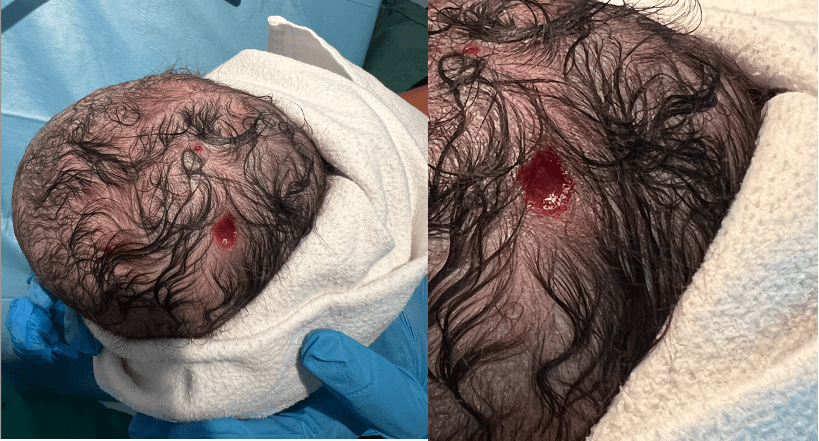 Spot Diagnosis
