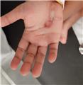 Spot Diagnosis
