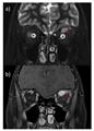 Spot Diagnosis