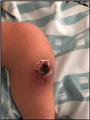 Spot Diagnosis