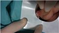 Spot Diagnosis