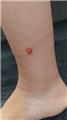 Spot Diagnosis