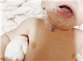 Spot Diagnosis