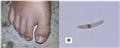 Spot Diagnosis