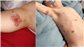 Spot Diagnosis