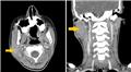 Spot Diagnosis