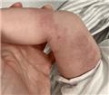 Spot Diagnosis