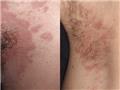 Spot Diagnosis