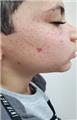 Spot Diagnosis