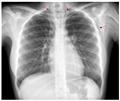 Spot Diagnosis