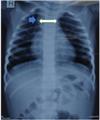Spot Diagnosis