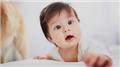 Aarskog Syndrome