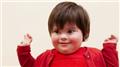Down's Syndrome