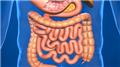 Malabsorption Syndromes