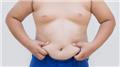 Gynaecomastia