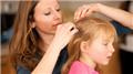 Head Lice