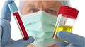 Hematuria (Blood in Urine)
