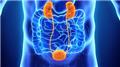 Hydronephrosis