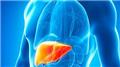 Alpha -1 Antitrypsin Deficiency
