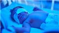 Jaundice in Newborn