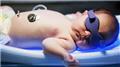Jaundice in Newborn