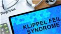 Klippel Feil Syndrome