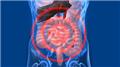 Malabsorption - Blood Picture