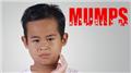 Mumps