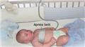 Neonatal Apnea