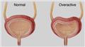 Neurogenic Bladder
