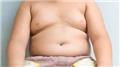 Obesity