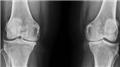 Rickets Radiology
