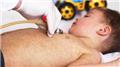 Rubella (German Measles)