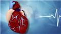 Arrhythmias
