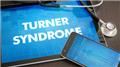 Turners Syndrome
